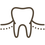 gummy smile treatment