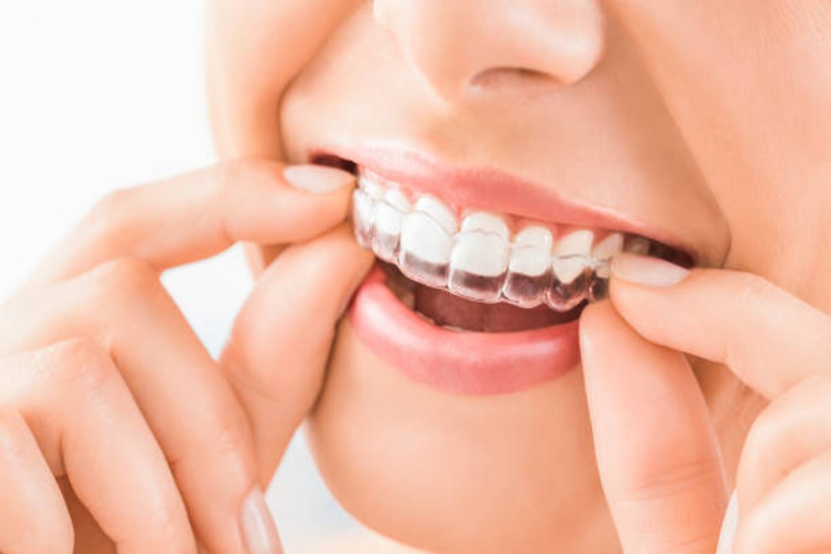 what dental problems can invisalign fix